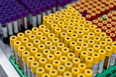 BASIC HEALTH CHECKUP